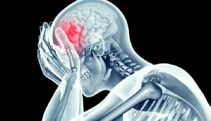 7 Terapi Efektif untuk Stroke Ringan agar Cepat Pulih dan Kembali Aktif