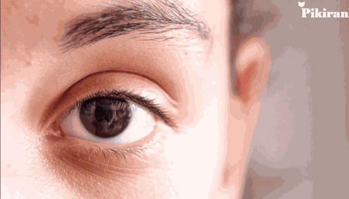 Sering Merasa Mata Gatal? Ini 6 Penyebab Umum dan Cara Mengatasinya