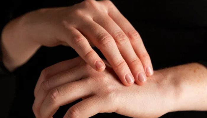 Tips Memutihkan Kulit Secara Alami dengan Kebiasaan Sehari-Hari