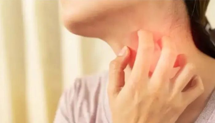 Cegah Luka Lecet dan Iritasi Kulit Saat Beraktivitas, Simak Tips Penting dari Dokter!